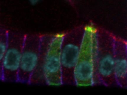 How cells change their shape
