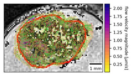 A first look at interstitial fluid flow in the brain