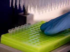 FLAM-Seq: Das ganze Bild der Boten-RNA und ihrer Enden