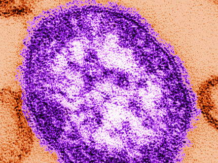 Masernvirus