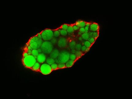 Protein kontrolliert Fettstoffwechsel