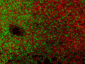 Biofilm de P. plecoglossicidia tras la tinción con Syto®9 (bacterias vivas) y yoduro de propidio (bacterias muertas)