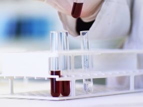 Listeria protein provides a CRISPR 'kill switch'