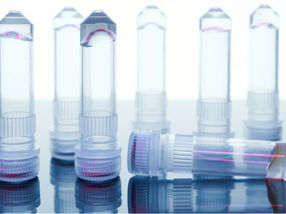 953 Indiana St, San Francisco, CA 94107  |  provenance.bio1Provenance Bio, an Alternative Protein Company, Creates Biomimetic, Animal-Free Gelatin Using Its Novel Microbial Protein Expression Platform
