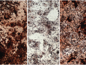 Fountain of youth for ageing stem cells in bone marrow
