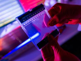 La variante de riesgo genético COVID-19 protege contra el VIH