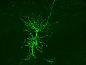 Lichtsonde zur Diagnose von Gehirnkrankheiten entwickelt