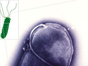 Bakterielle Fußfessel: Bewegungshemmende Wirkstoffe gegen den Magenkeim Helicobacter pylori