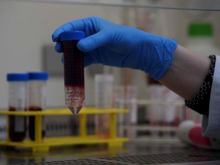 Protection against COVID-19: experience is not always an advantage for the immune response