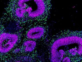 Mapping human brain development