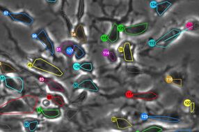 stem cells