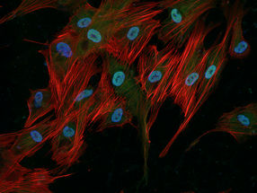 Reprogrammierung von Fruchtwasser-Stammzellen in Richtung Pluripotenz