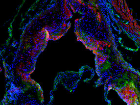 La molécula cortistatina reduce el número y tamaño de las placas de grasa en el sistema cardiovascular