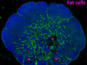 Comment la graisse s'empare des ganglions lymphatiques avec l'âge