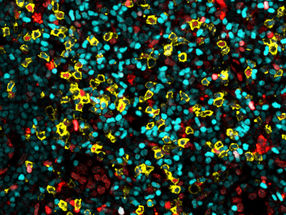 Resident T cells detected in lymph nodes