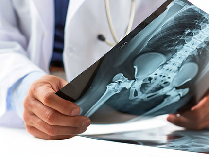 Immune cells strengthen bones