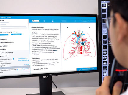La IA para la documentación médica es un mercado de futuro en rápido crecimiento