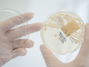 A Second Chance for New Antibiotic Agent