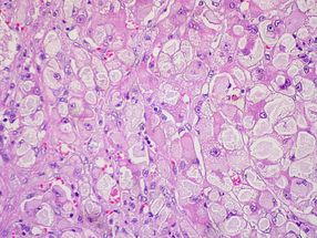 Researchers decipher mechanisms of liver regeneration