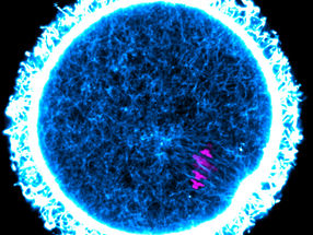 Egg cell maintenance: Long-lived proteins may be essential