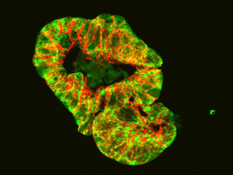 © Lehrstuhl für Ernährung und Immunologie / TUM