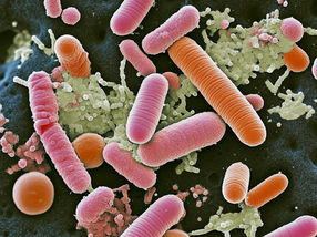 QIAGEN collabore avec l'Université McGill pour faire avancer la recherche sur le microbiome