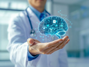 La inteligencia artificial determina el momento de la carrera con gran precisión